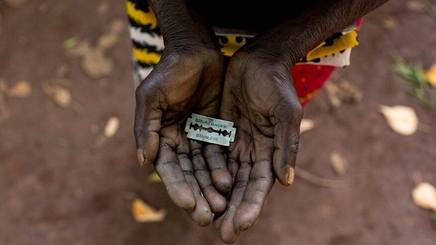 La ablación en África: práctica cultural y repercusiones en la salud.